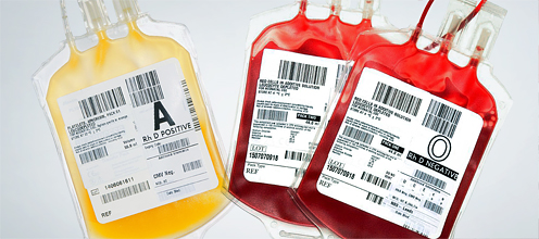 tipi-donazione
